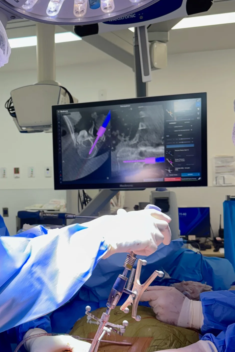 Cirurgia da coluna com navegação por imagem
